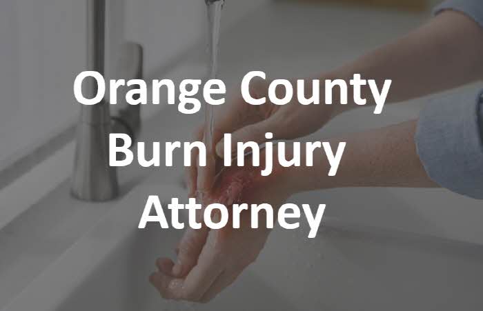 교통사고 변호사, 개인상해 변호사, 화상사고 변호사